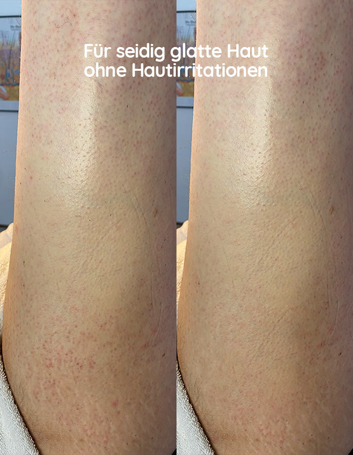AfterCare Oil – Waxing Nachbehandlungsöl
