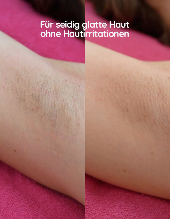 peeling handschuhe eingewachsene haare Peeling-Handschuh – Pink